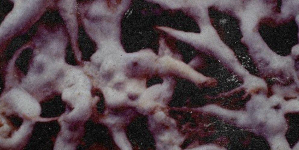 list image