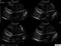 Imágenes de ultrasonido veterinario portátil VU10 4Bmode