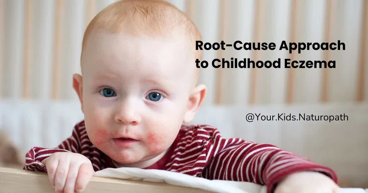 A Root-Cause Approach to Childhood Eczema: What Every Parent Should Understand