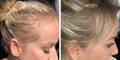 Nulastin-Scalp-Hair-Results-Before-After