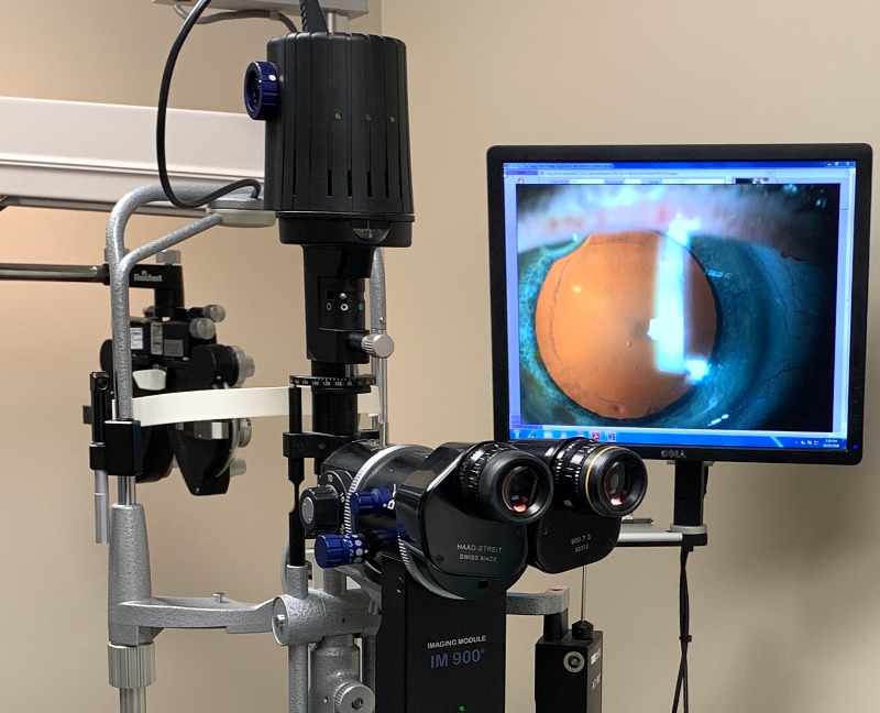 Slit-lamp microscope to examine for cataracts