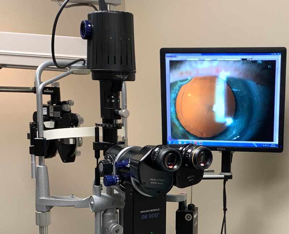 Slit-lamp microscope to examine for cataracts