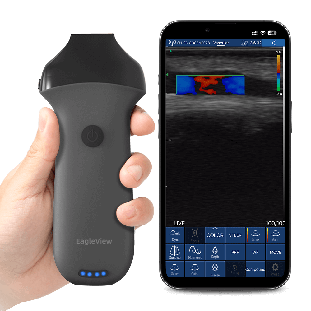 Eagleview Linear Wireless Probe Type Ultrasound Scanner