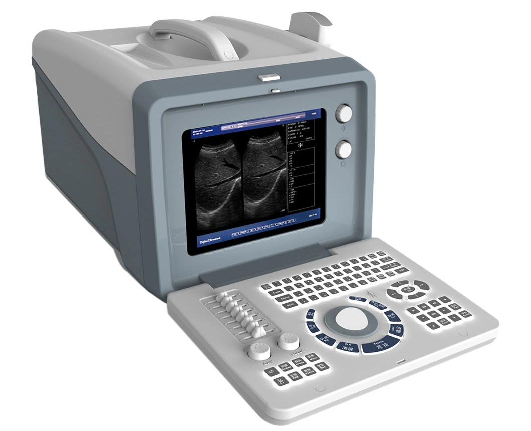 B/W Ultrasound Machine 