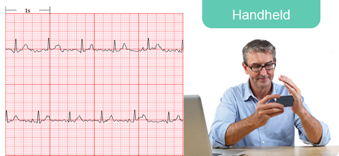 Ableitung I EKG von Hand aufzeichnen