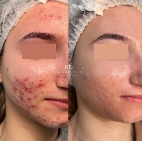 Haus of Dermal Voucher - Image 3