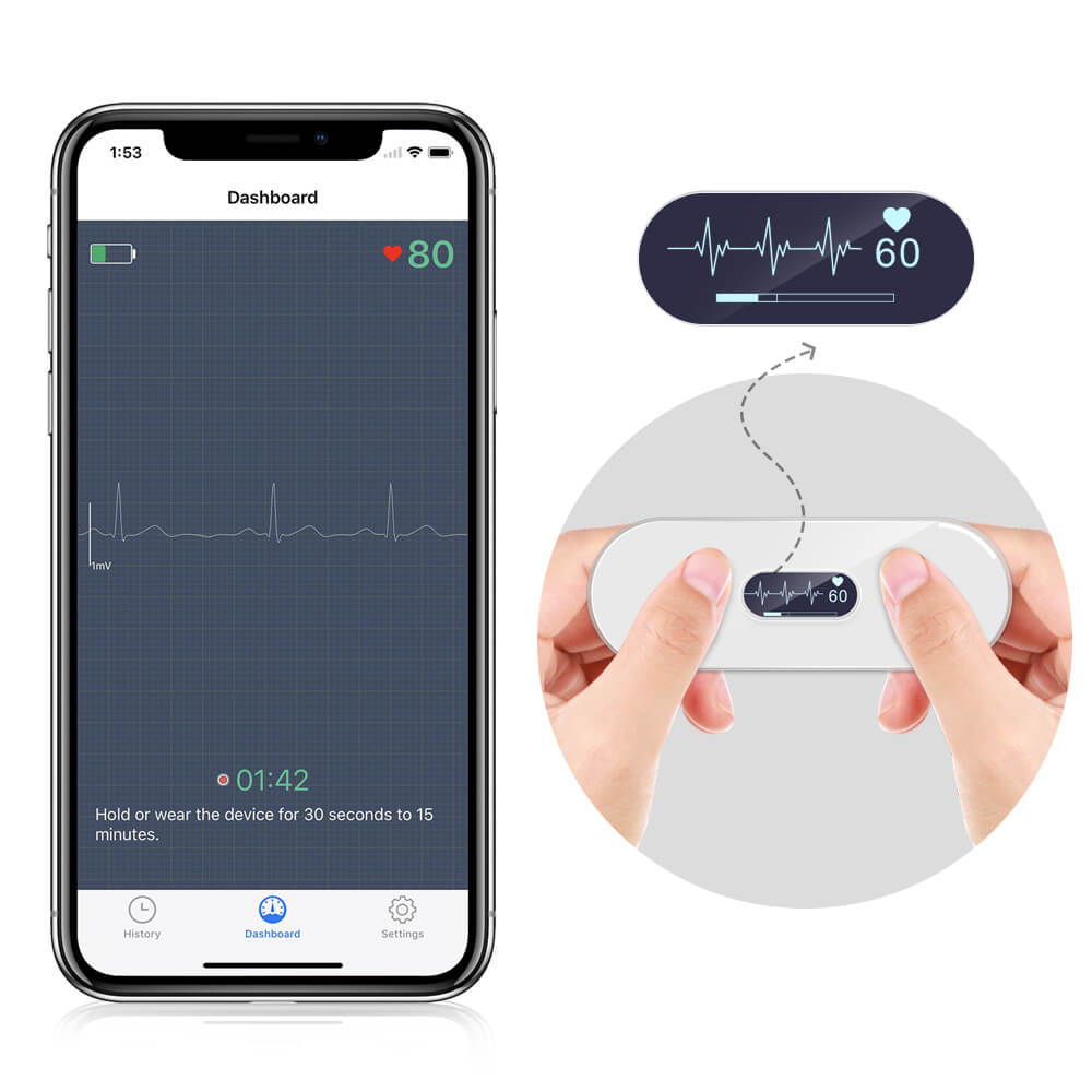 Wellue 12-Kanal-Holter-Monitor mit KI-Analyse