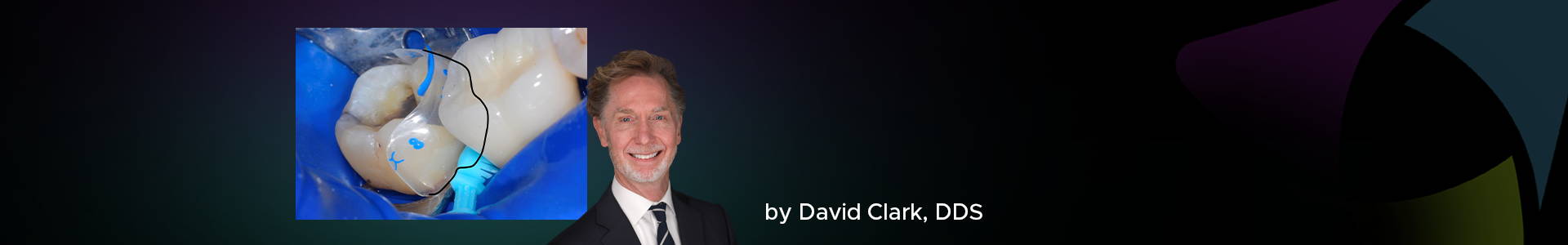 David Clark's Class II restoration blog post banner