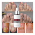 fight nail fungus with Nail Repair  Essence
