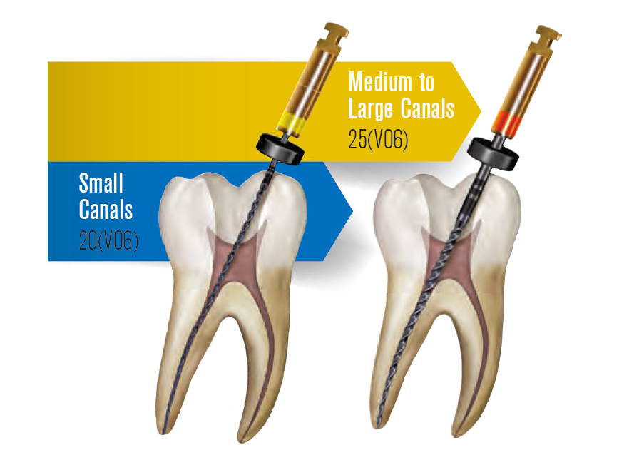 1-2 File Shaping-Finishing System