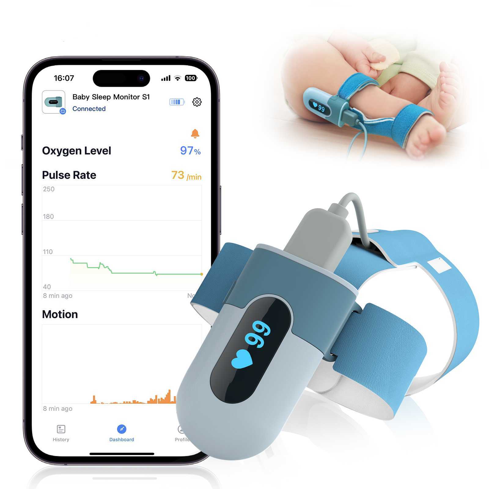El monitor de sueño para bebés Smart Sock portátil rastrea el nivel de O2,  la frecuencia cardíaca y el movimiento del bebé, con notificaciones de  aplicaciones, se adapta a bebés de 0