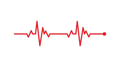 مخطط كهربية القلب (EKG / ECG)
