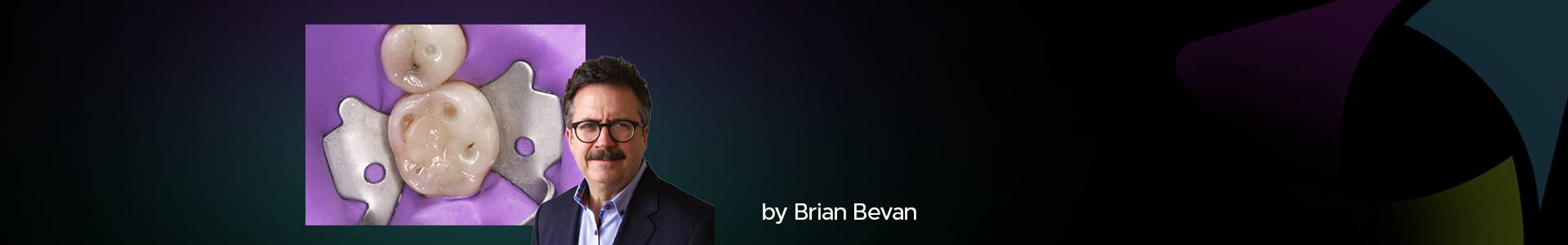 blog banner featuring Brian Bevan and clinical image in the back