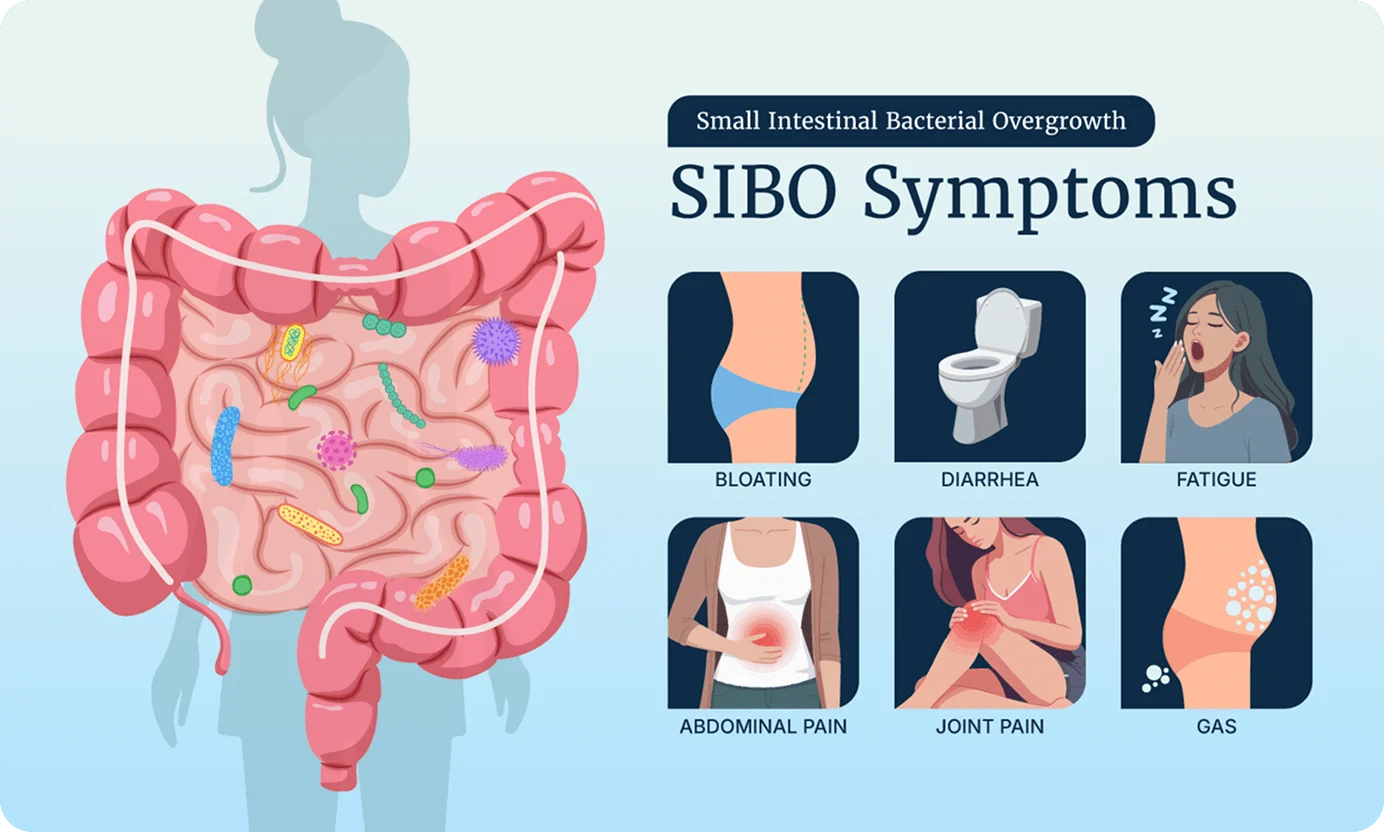 SIBO (Small Intestinal Bacterial Overgrowth): Symptoms, Causes, & Treatment -