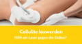 laserbehandlung gegen cellulite