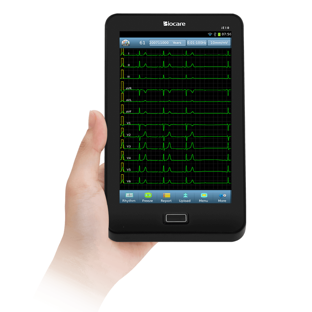 タブレットベースの便利な 12 チャンネル ECG デバイス