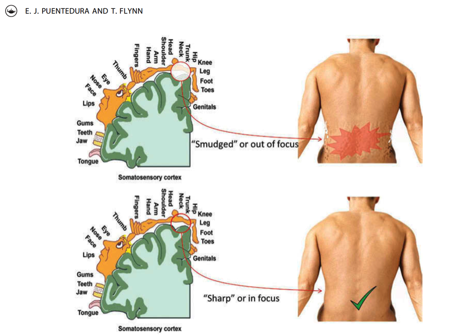 Chronic Lower Back Pain and Joint Position Sense – Motion Guidance
