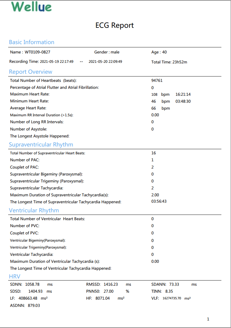 ecg report analysis,