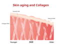Collagen and aging