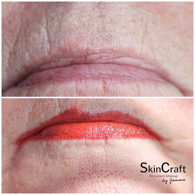 PERMANENT LIPS | Skincraft