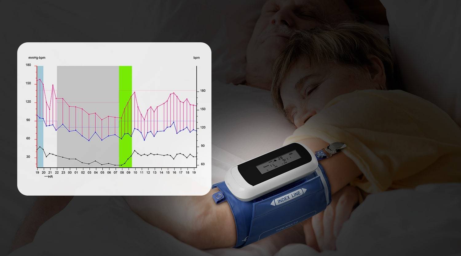 ABPM tracks blood pressure 24/7 and indicates the whole day's blood pressure fluctuation.