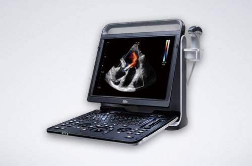 Chison Demo Ultrasounds