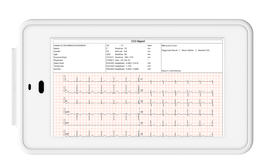L'ECG de poche Wellue à 12 dérivations permet aux utilisateurs d'exporter et d'imprimer des rapports ECG