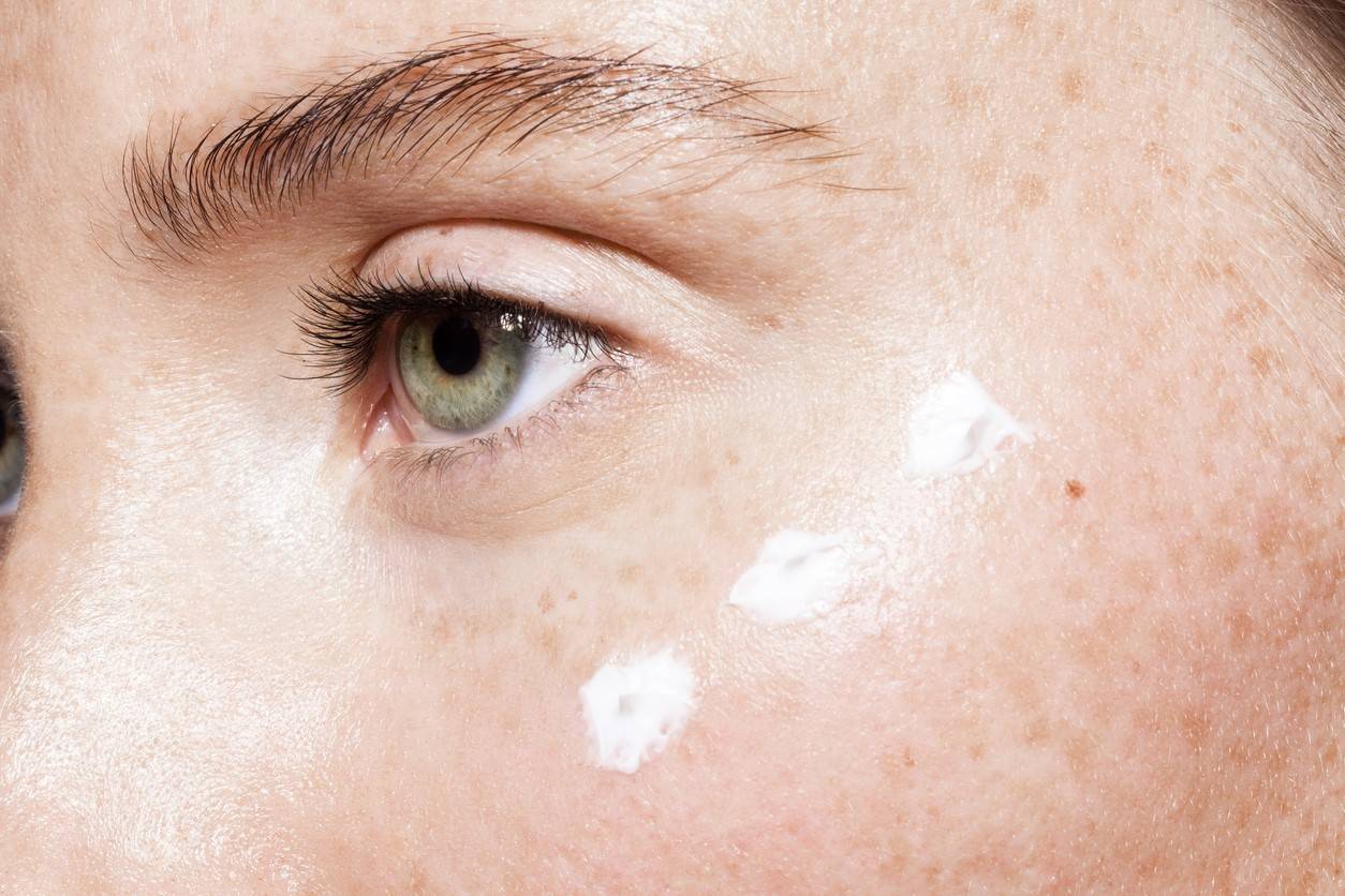 hand with age spots being treated at the skin clinic