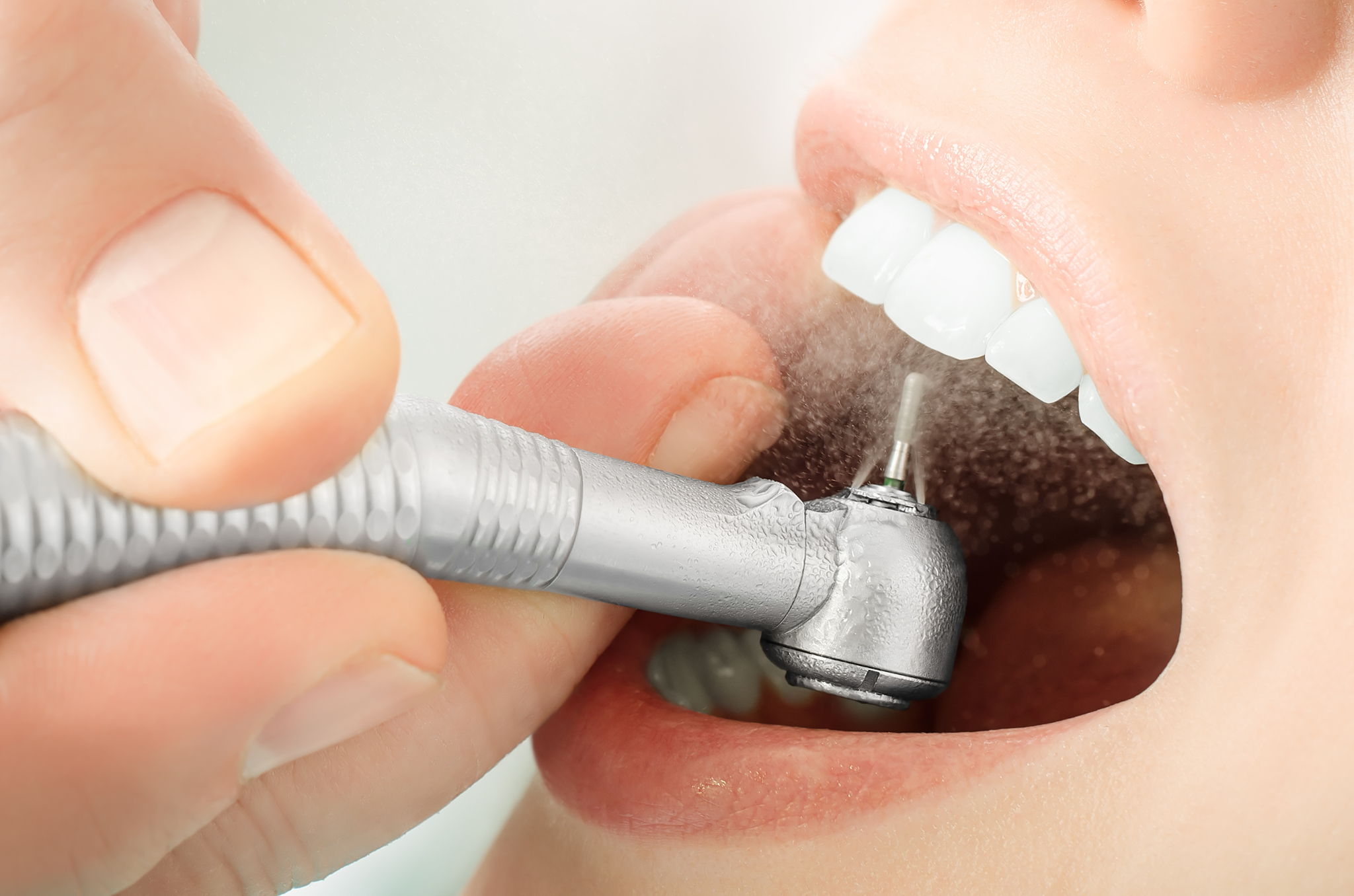 What is Holistic Dentistry? -