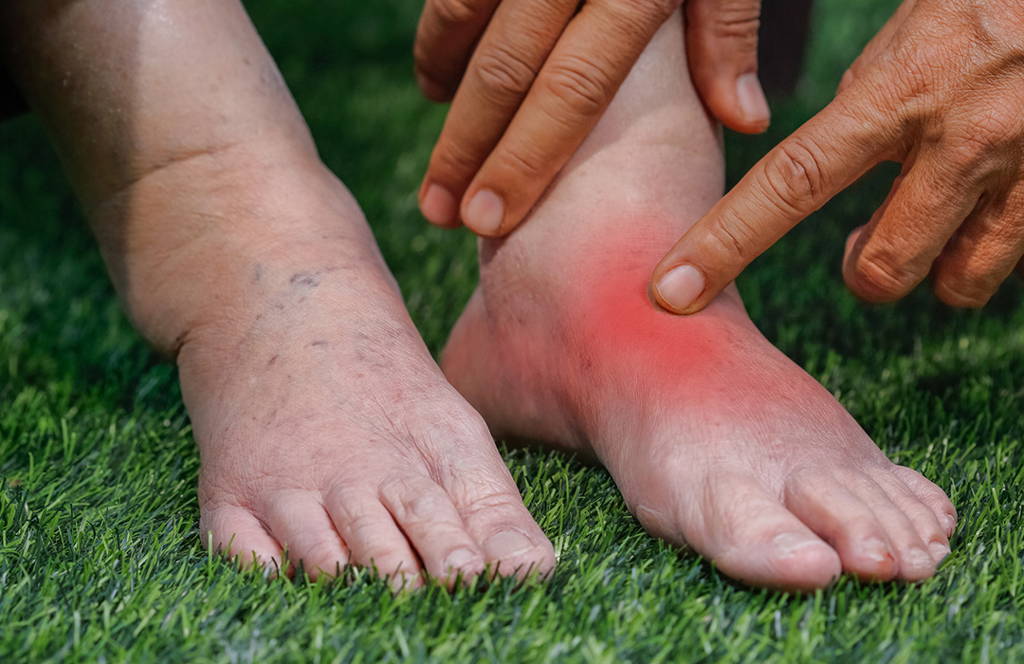 relieve foot pains, onecompress bamboo footsleeves, sad woman