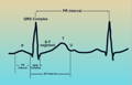 EKG-Anzeigediagramm