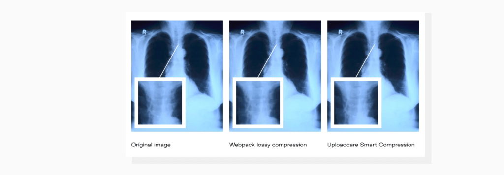 The results produced by Uploadcare Smart Compression compared to regular compression. A comparison of Uploadcare Smart Compression with other methods of compression