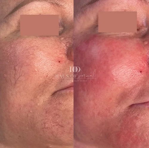 Haus of Dermal Voucher - Image 2