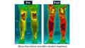 Graphic of blood flow before and after vibration treatment