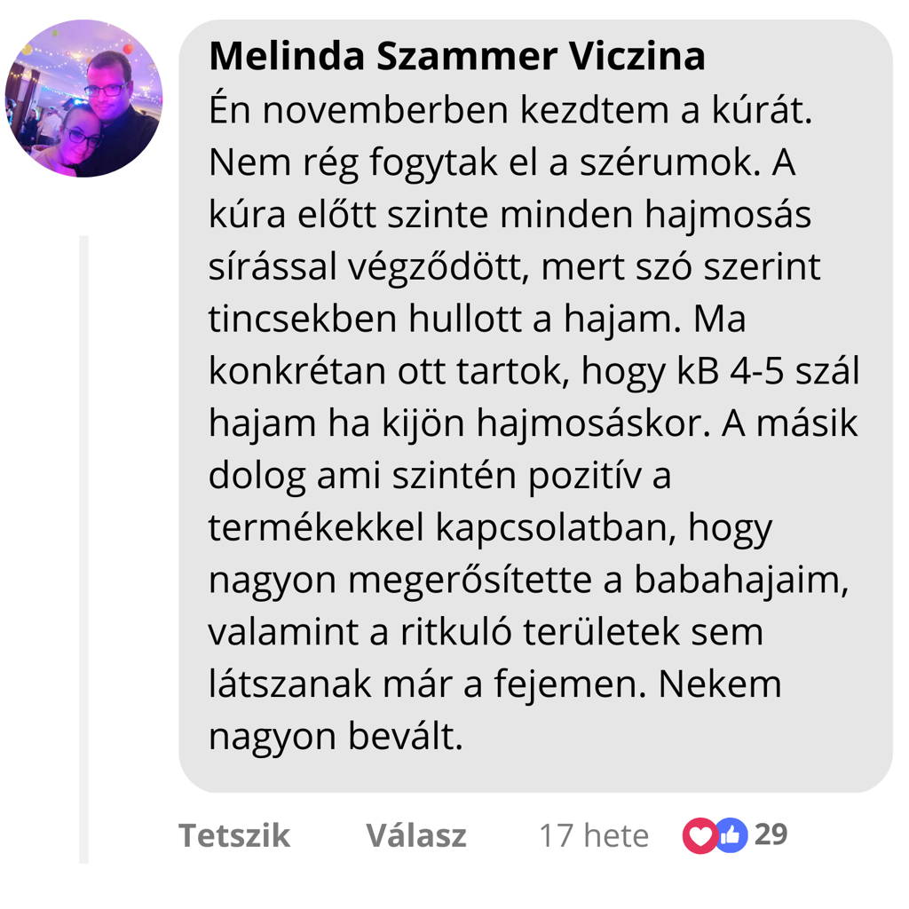 Vásárlói vélemény a hajhullás csökkenéséről és babahajak megerősödéséről a TheSilkyWay kúra után