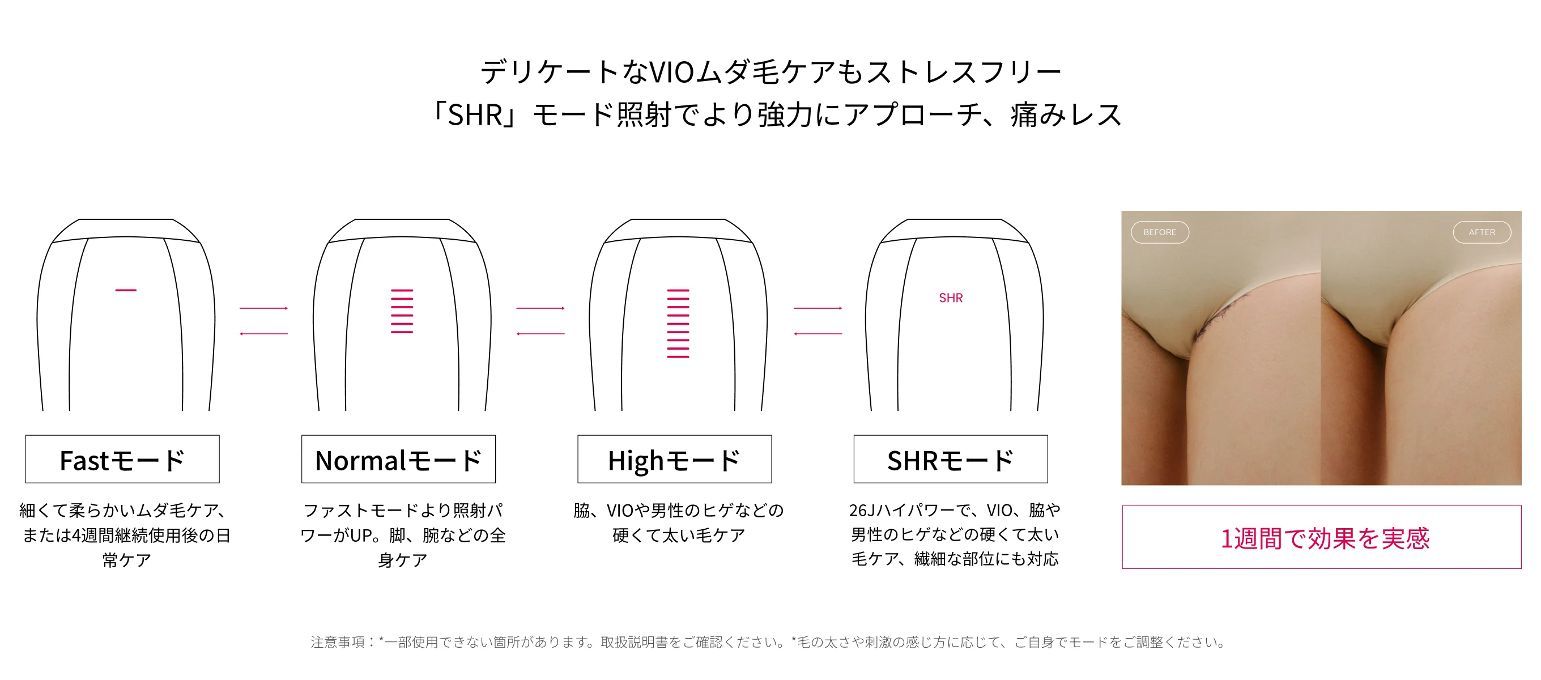 ストレスフリー