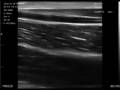 Ultraschallbild des Gefäßsystems