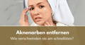 Aknenarben entfernen