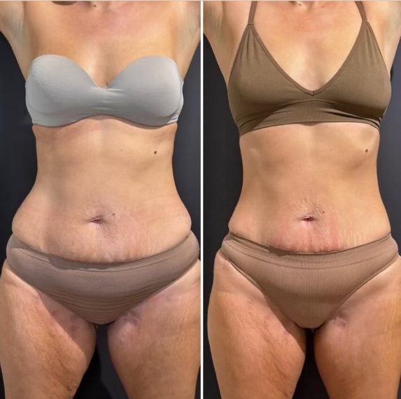 Bliss Wellness Hub - Voucher - Image 5