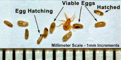 bed-bug-eggs-pictures-6