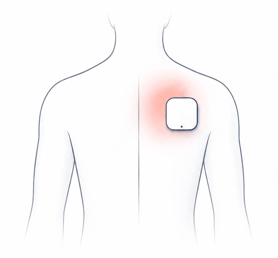 Single-channel TENS setup targeting one treatment area at a time.