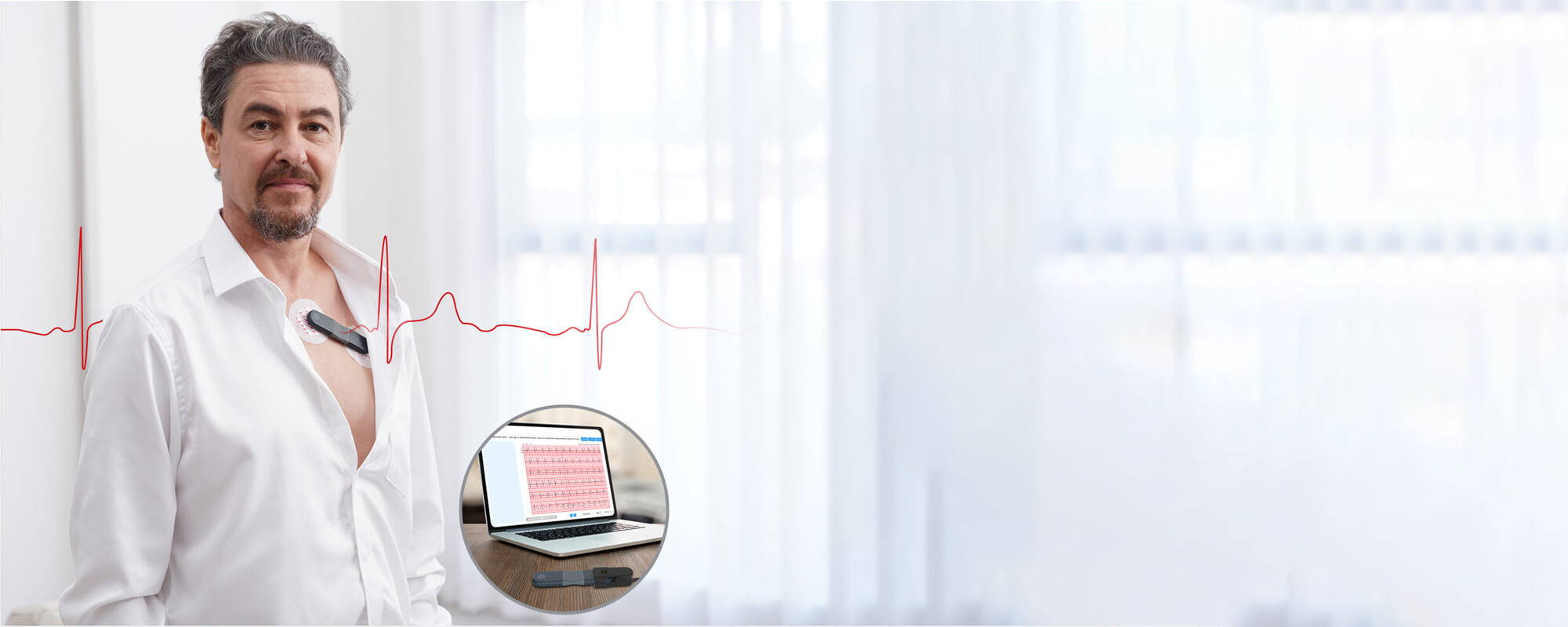 Registrador de ECG de 24 horas Wellue con análisis de IA, monitor Holter de 24 horas