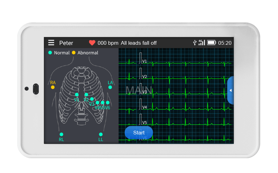 Anleitung zur EKG-Platzierung auf dem Bildschirm