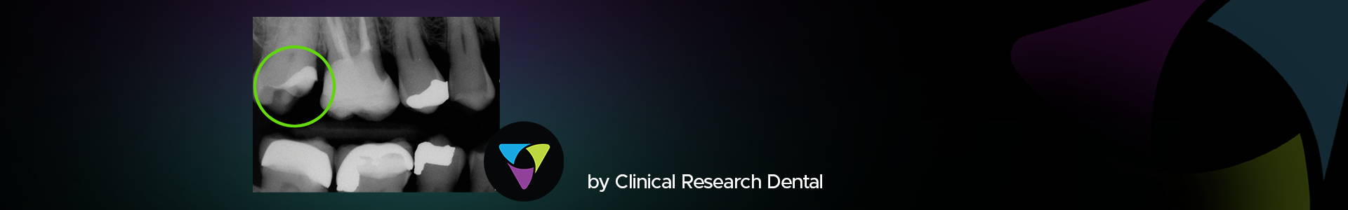 blog banner with dental x-ray and Clinical Research Dental logo