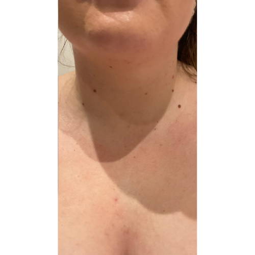 Hydrachest After