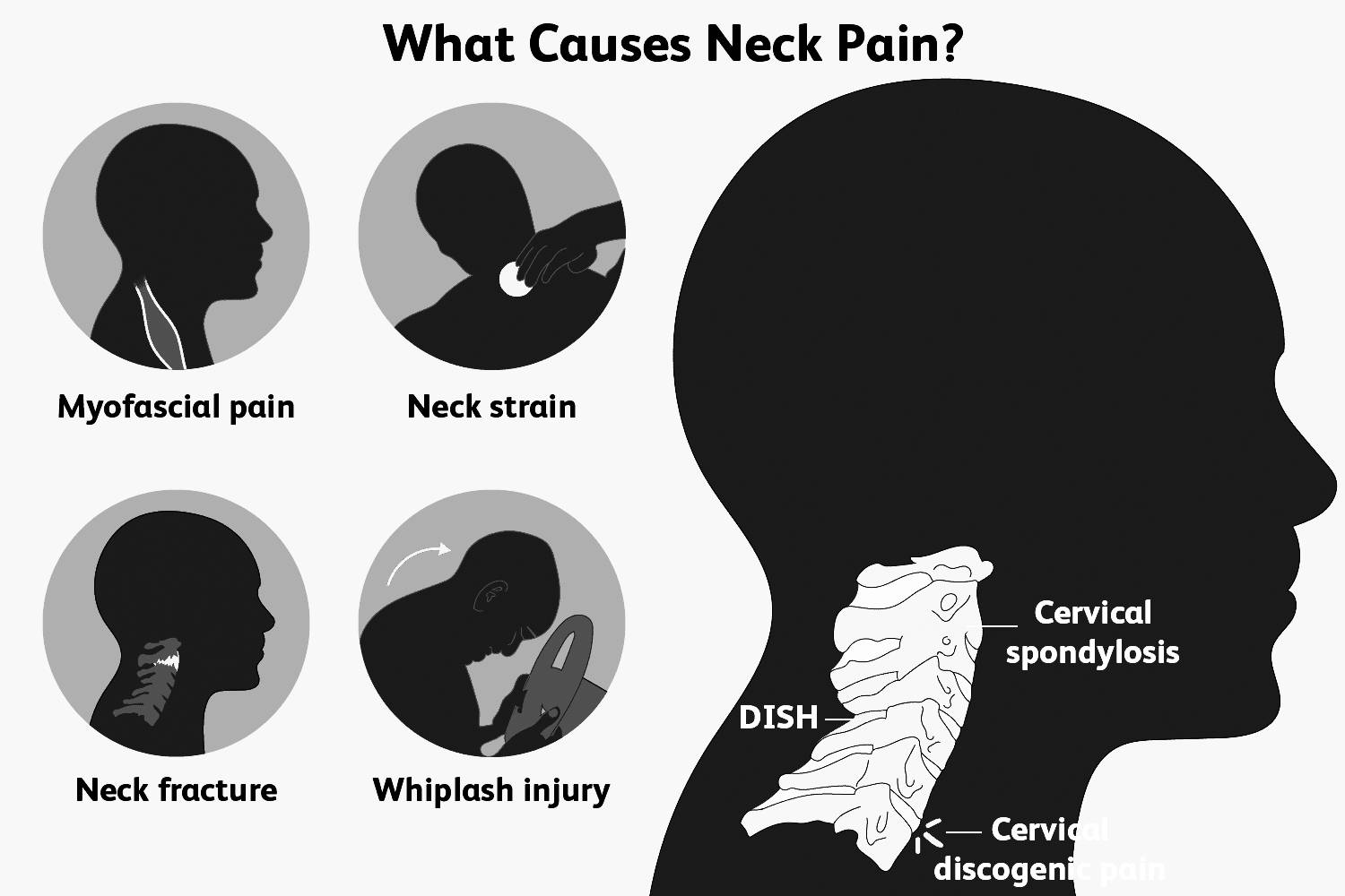 neck traction at home ,  dangers of cervical traction ,  best neck traction device ,  neck traction device for home ,  neck traction device reviews ,  chiropractic neck traction device ,  neck stretcher how to use ,  neck traction at home ,  dangers of cervical traction ,  best neck traction device ,  neck traction device for home ,  neck traction device reviews ,  cervical neck traction device ,  neck cervical traction device ,  best neck traction device ,  home neck traction device ,  neck traction device amazon ,  best neck traction device  ,  neck traction device reviews ,  chiropractic neck traction device ,  saunders neck traction device ,  neck traction device near me ,  cervical neck traction device reviews ,  how to use neck traction device ,  how to use cervical neck traction device ,  branfit neck traction device ,  neck traction device at home ,  neck air traction device ,  neck traction device australia ,  neck traction device uk ,  neck traction device nz USA ,  neck traction device how to use ,  neck traction device reddit ,  neck cloud - cervical traction device ,  neckfix cervical traction device ,  exercises for neck and shoulder pain myofascial pain syndrome how to relieve neck pain from sleeping wrong lump on right side of neck no pain carotidynia occipital neuralgia symptoms fibromyalgia lump on left side of neck no pain trapezius muscle pain trapezius muscle cervicogenic headache physical therapy for neck pain spinal stenosis neck pain in children shoulder and neck pain on right side how to cure neck pain fast neck pain left side back of neck pain neck pain right side neck pain exercises how to cure neck pain fast neck pain treatment types of neck pain female back neck pain neck pain left side neck pain right side neck pain exercises how to cure neck pain fast neck pain treatment best pillow for neck pain neck pain relief pillows for neck pain shoulder and neck pain neck and shoulder pain neck pain left side back of neck pain neck pain right side neck pain and headache neck pain covid neck muscle pain neck pain exercises neck and shoulder pain on left side neck and shoulder pain on right side neck and back of head pain neck pain from sleeping how to cure neck pain fast how to relieve neck pain shoulder and neck pain on right side neck pain treatment how to get rid of neck pain neck and back pain severe neck pain chronic neck pain neck and shoulder pain radiating down arm neck pain after sleepingNeck traction  device , Cervical tractor , cervical traction device , saunders cervical traction device , neck pain relief , neck pain treatment , neck brace , neck hammock , neckk traction brace , effective neck pain relief , fast neck pain relief 