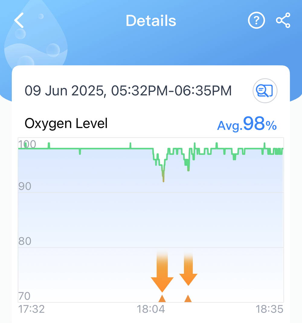 Graphique du niveau d'oxygène O2Ring montrant de brèves baisses pendant la surveillance