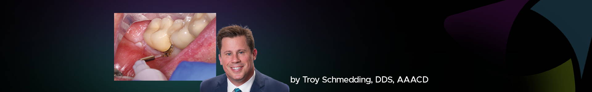 blog banner featuring Dr Troy Schmedding and a clinical image