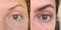 Nulastin Lash Serum Results Before After