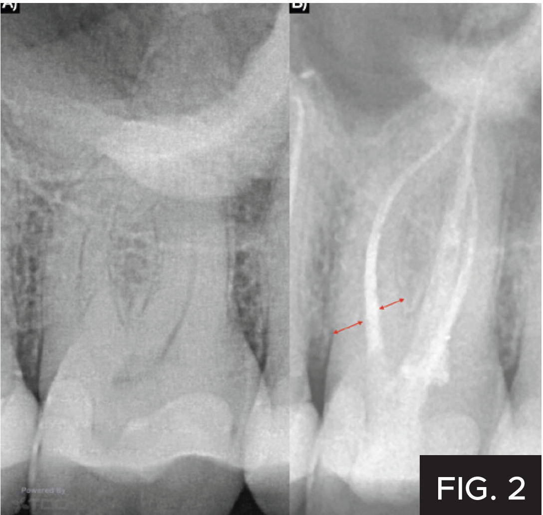 Dr. Nadeau case: figure 2